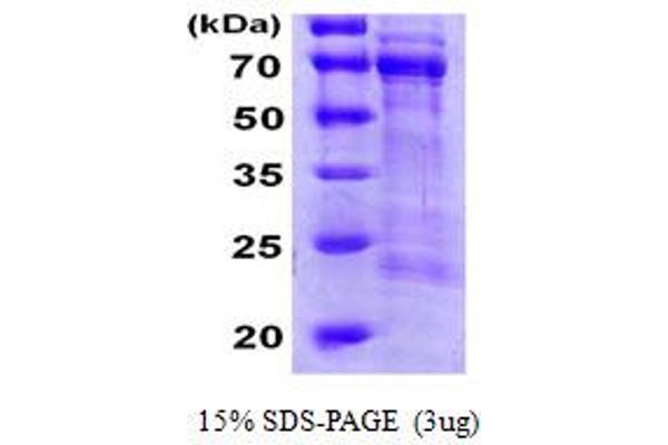 CDC25A Protein (AA 1-524) (His tag)