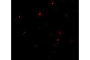 Immunofluorescence of PEN2 in K562 cells with this product at 20 μg/ml. (PEN2 antibody  (C-Term))