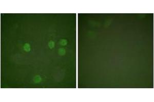 Immunofluorescence analysis of HeLa cells, using Cyclin B1 (Ab-126) Antibody. (Cyclin B1 antibody  (AA 91-140))