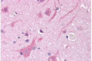 Human Brain, Cortex (formalin-fixed, paraffin-embedded) stained with SCN5A antibody ABIN290512 at 5-10 ug/ml followed by biotinylated anti-goat IgG secondary antibody ABIN481715, alkaline phosphatase-streptavidin and chromogen. (SCN5A antibody  (AA 1548-1558))