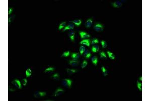 Immunofluorescence (IF) image for anti-Complement Component (3d/Epstein Barr Virus) Receptor 2 (CR2) (AA 761-964) antibody (ABIN7148413)