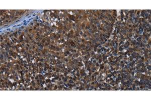 Immunohistochemistry of paraffin-embedded Human tonsil using GALT Polyclonal Antibody at dilution of 1:30 (GALT antibody)