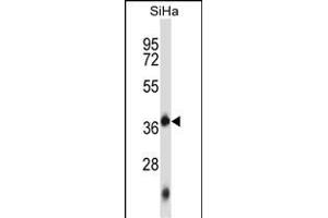 DNTTIP1 Antibody (Center) (ABIN657126 and ABIN2846270) western blot analysis in SiHa cell line lysates (35 μg/lane).