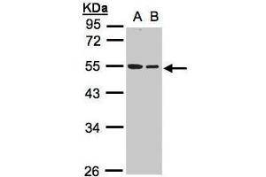 WB Image Sample(30 ug whole cell lysate) A:A431, B:Hep G2 , 10% SDS PAGE antibody diluted at 1:1000 (TUBB1 antibody)