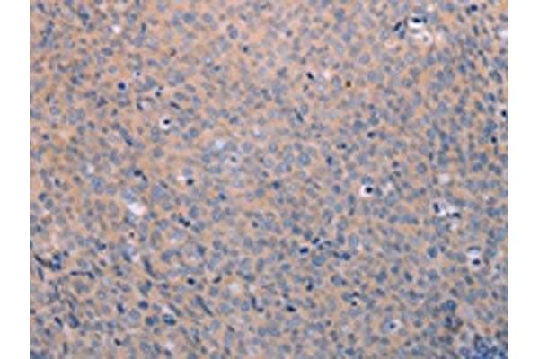 ANKRD26 antibody