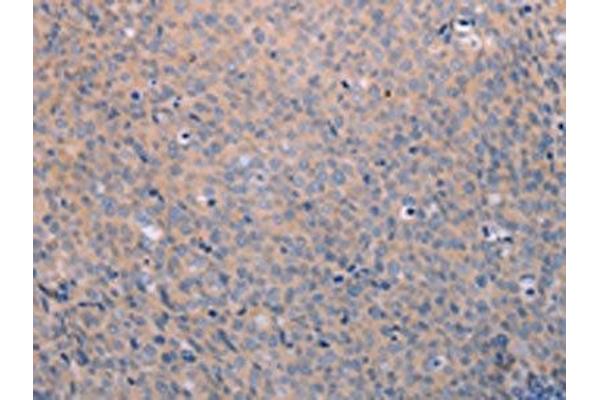 ANKRD26 antibody