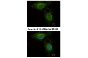 ICC/IF Image Immunofluorescence analysis of methanol-fixed HeLa, using PHGDH, antibody at 1:500 dilution. (PHGDH antibody  (N-Term))