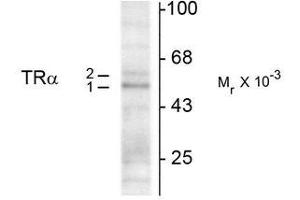 Western Blotting (WB) image for anti-Thyroid Hormone Receptor, alpha (THRA) (N-Term) antibody (ABIN371843) (THRA antibody  (N-Term))