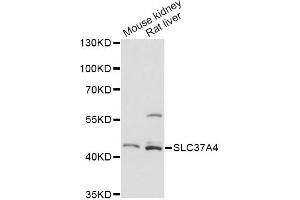 Western blot analysis of extracts of various cell lines, using SLC37A4 antibody.