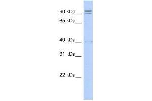 WB Suggested Anti-TTC14 Antibody Titration:  0. (TTC14 antibody  (N-Term))