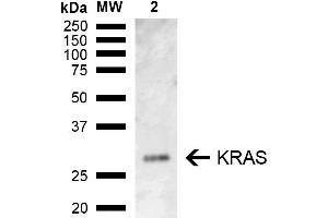 Western blot analysis of Rat Kidney showing detection of ~21. (K-RAS antibody  (AA 100-189) (HRP))