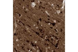 Immunohistochemical staining of human cerebral cortex with HS6ST2 polyclonal antibody  shows strong cytoplasmic positivity in neuronal cells at 1:50-1:200 dilution. (HS6ST2 antibody)