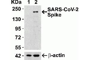 Overexpression Validation in Spike Transfected 293 Cells Loading: 10 μg per lane of 293 cell lysate. (SARS-CoV-2 Spike antibody  (RBD))