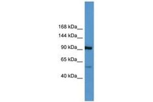 Image no. 1 for anti-Apolipoprotein A (APOA) (AA 3962-4011) antibody (ABIN6746793) (LPA antibody  (AA 3962-4011))