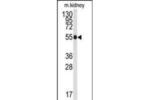 Western blot analysis of anti-ALDH9A1 Antibody (C-term) (ABIN392321 and ABIN2841971) in mouse kidney tissue lysates (35 μg/lane). (ALDH9A1 antibody  (C-Term))