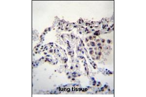 MEIG1 Antibody (Center) (ABIN656380 and ABIN2845675) immunohistochemistry analysis in formalin fixed and paraffin embedded human lung tissue followed by peroxidase conjugation of the secondary antibody and DAB staining. (MEIG1 antibody  (AA 36-65))