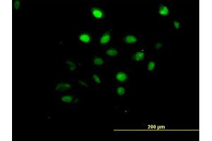Immunofluorescence of monoclonal antibody to AKT1 on HeLa cell. (AKT1 antibody  (AA 1-480))