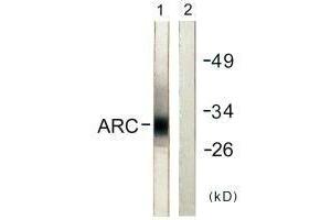 Western blot analysis of extracts from HeLa cells, using ARC antibody. (ARC antibody)