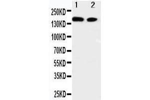 Anti-ErbB 4 antibody, Western blotting Lane 1: A549 Cell Lysate Lane 2: HELA Cell Lysate (ERBB4 antibody  (N-Term))