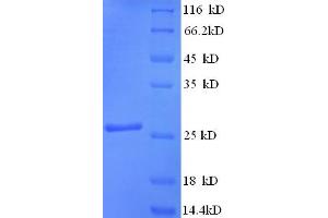SDS-PAGE (SDS) image for YOAJ (AA 26-232) protein (His-SUMO Tag) (ABIN5711191)