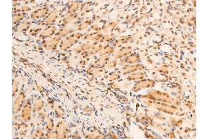 ABIN6267069 at 1/100 staining mouse gastric tissue sections by IHC-P. (NFKBIA antibody  (pSer32, pSer36))