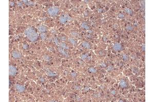 Immunohistochemistry analysis using Mouse Anti-GABA A Receptor Monoclonal Antibody, Clone N87/25 (ABIN2483488).