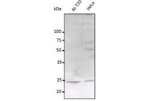 RAB11A antibody  (C-Term)