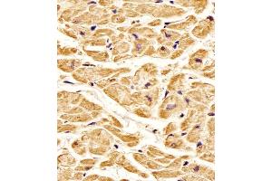 Antibody staining ROR1 in Human heart tissue sections by Immunohistochemistry (IHC-P - paraformaldehyde-fixed, paraffin-embedded sections).