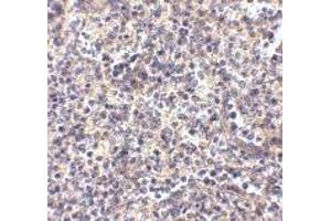 Immunohistochemistry (IHC) image for anti-ATG5 Autophagy Related 5 (ATG5) (N-Term) antibody (ABIN1031248) (ATG5 antibody  (N-Term))
