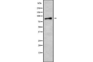 Western blot analysis of AMPD3 using MCF7 whole cell lysates (AMPD3 antibody  (Internal Region))