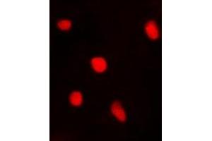 Immunofluorescent analysis of BTEB1 staining in A549 cells. (KLF9 antibody)