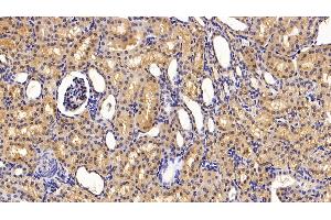 Detection of TBG in Porcine Kidney Tissue using Polyclonal Antibody to Thyroxine Binding Globulin (TBG)