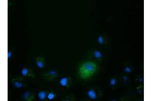 Anti-CD80 mouse monoclonal antibody (ABIN2452902) immunofluorescent staining of COS7 cells transiently transfected by pCMV6-ENTRY CD80 (RC206540). (CD80 antibody)