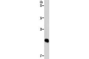 Gel: 12 % SDS-PAGE, Lysate: 40 μg, Lane: MCF7 cells, Primary antibody: ABIN7192097(RAB22A Antibody) at dilution 1/650, Secondary antibody: Goat anti rabbit IgG at 1/8000 dilution, Exposure time: 30 seconds (RAB22A antibody)