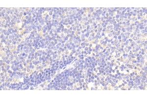 Detection of MMP13 in Human Lymph node Tissue using Polyclonal Antibody to Matrix Metalloproteinase 13 (MMP13)