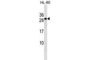 TMED6 Antibody (Center) western blot analysis in HL-60 cell line lysates (35 µg/lane). (TMED6 antibody  (Middle Region))