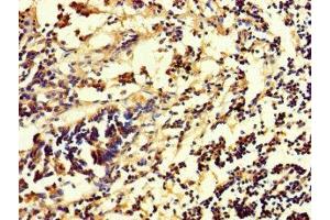 Immunohistochemistry of paraffin-embedded human appendix tissue using ABIN7154641 at dilution of 1:100 (RHEBL1 antibody  (AA 1-180))