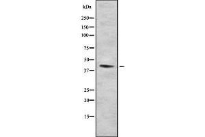 Western blot analysis FNTA using COLO205 whole cell lysates (FNTA antibody  (N-Term))