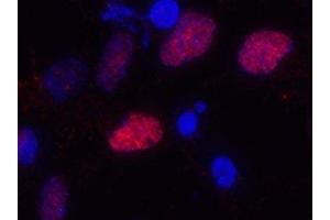 Immunostaining of primary rat cortical neuroepithelial cells with anti-Olig2 (red). (OLIG2 antibody)