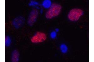Immunostaining of primary rat cortical neuroepithelial cells with anti-Olig2 (red). (OLIG2 antibody)