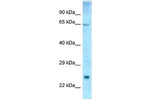 WB Suggested Anti-ETFDH Antibody Titration: 1.