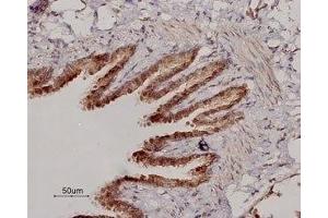Immunohistochemistry (IHC) image for anti-Adrenergic, beta-2-, Receptor, Surface (ADRB2) (AA 15-30), (Extracellular) antibody (ABIN7042904)
