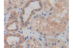 Detection of IREB2 in Human Kidney Tissue using Polyclonal Antibody to Iron Responsive Element Binding Protein 2 (IREB2) (IREB2 antibody  (AA 39-281))