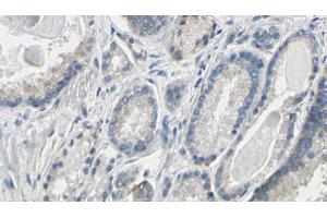 ABIN6274786 at 1/100 staining Human prostate tissue by IHC-P. (PGLS antibody  (C-Term))