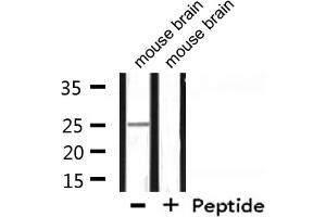 Western blot analysis of extracts from mouse brain, using RPL10 Antibody. (RPL10 antibody  (N-Term))