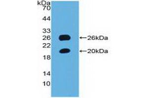 Detection of Recombinant SPON1, Mouse using Polyclonal Antibody to Spondin 1 (SPON1) (SPON1 antibody  (AA 608-802))