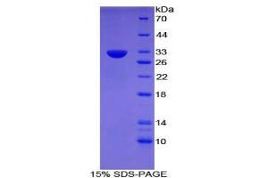 SDS-PAGE analysis of Mouse CD109 Protein. (CD109 Protein (CD109))