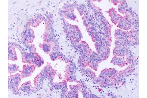 Anti-GPR63 antibody IHC of human prostate. (GPR63 antibody  (Extracellular Domain))