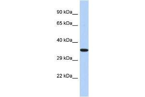 Western Blotting (WB) image for anti-Epoxide Hydrolase 4 (EPHX4) (C-Term) antibody (ABIN2786305) (EPHX4 antibody  (C-Term))
