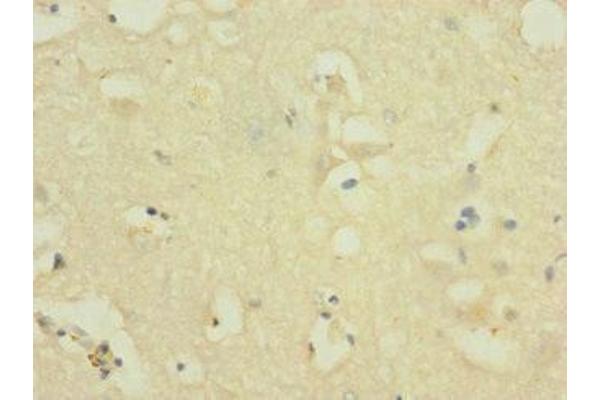 NOX3 antibody  (AA 223-395)